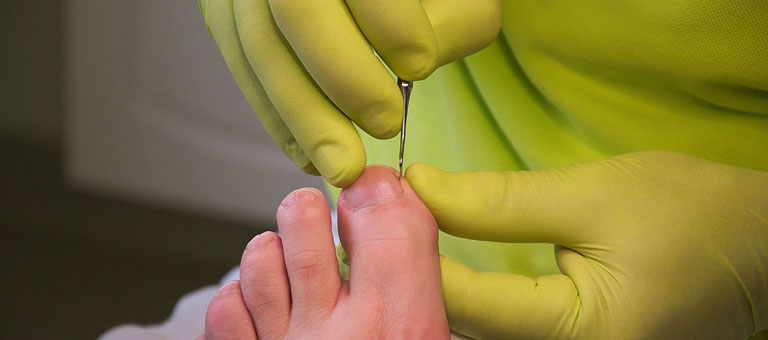 Chiropody in Clapham