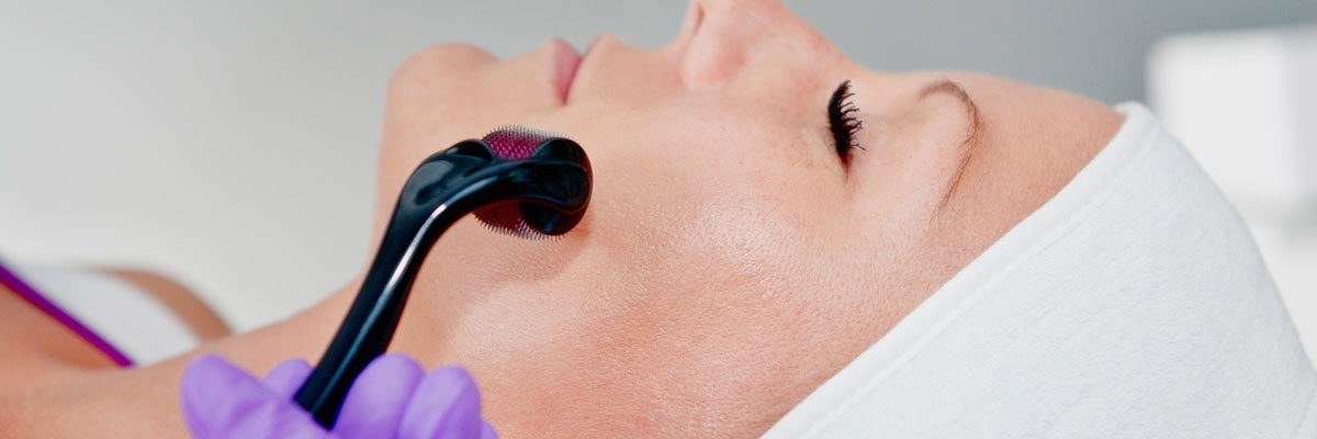 Collagen Induction Therapy