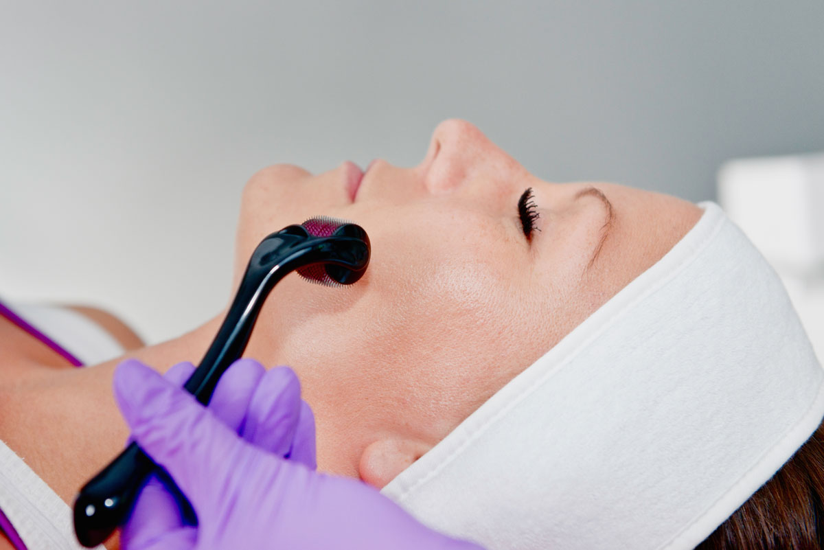 Collagen Induction Therapy