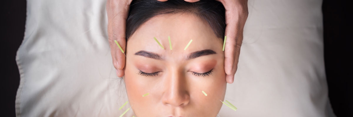 Cosmetic Acupuncture